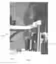 Fig. 02 - DEVICE AND METHOD TO TREAT BLOOD VESSELS IN THE EYE