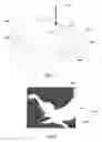 Fig. 04 - DEVICE AND METHOD TO TREAT BLOOD VESSELS IN THE EYE