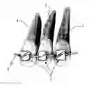 Fig. 01 - Self-ligating orthodontic passive low-friction bracket and method for mounting an arch wire on said bracket