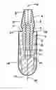 Fig. 01 - Multi part non metal implant