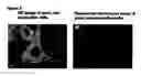 Fig. 06 - System for functional analysis of polypeptides