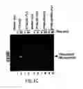 Fig. 08 - Methods and compositions for use in spliceosome mediated RNA trans-splicing
