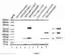 Fig. 02 - Method and kit for the diagnosis or treatment control of intestinal carcinoma