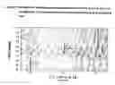 Fig. 04 - Methods to predict cholesterol elevation during immunosuppressant therapy