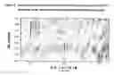 Fig. 07 - Methods to predict cholesterol elevation during immunosuppressant therapy