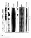 Fig. 07 - RNA expression profile predicting response to tamoxifen in breast cancer patients