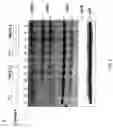 Fig. 12 - RNA expression profile predicting response to tamoxifen in breast cancer patients