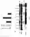 Fig. 13 - RNA expression profile predicting response to tamoxifen in breast cancer patients