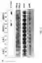 Fig. 19 - RNA expression profile predicting response to tamoxifen in breast cancer patients