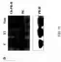 Fig. 22 - RNA expression profile predicting response to tamoxifen in breast cancer patients