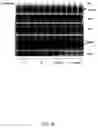 Fig. 26 - RNA expression profile predicting response to tamoxifen in breast cancer patients
