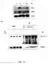Fig. 27 - RNA expression profile predicting response to tamoxifen in breast cancer patients