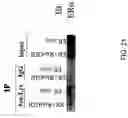 Fig. 32 - RNA expression profile predicting response to tamoxifen in breast cancer patients
