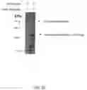 Fig. 33 - RNA expression profile predicting response to tamoxifen in breast cancer patients