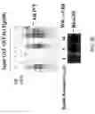 Fig. 37 - RNA expression profile predicting response to tamoxifen in breast cancer patients