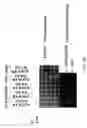 Fig. 40 - RNA expression profile predicting response to tamoxifen in breast cancer patients