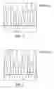 Fig. 03 - Method for the detection of predisposition to high altitude pulmonary edema