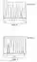 Fig. 04 - Method for the detection of predisposition to high altitude pulmonary edema