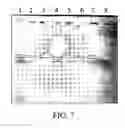 Fig. 06 - Method for the detection of predisposition to high altitude pulmonary edema