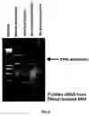 Fig. 12 - Method for generating variable domain sequences of heavy chain antibodies