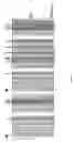 Fig. 07 - Switch-region: target and method for inhibition of bacterial RNA polymerase