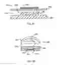Fig. 34 - Miniaturized genetic analysis systems and methods