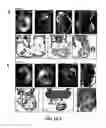 Fig. 03 - Micro-RNA's that regulate muscle cells
