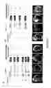Fig. 04 - Micro-RNA's that regulate muscle cells