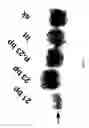 Fig. 09 - Micro-RNA's that regulate muscle cells