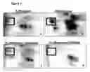 Fig. 08 - Modulation of the synthesis of insulin