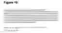 Fig. 17 - Modulation of the synthesis of insulin
