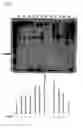 Fig. 06 - Method for detecting perilymphatic fistula