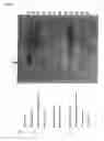 Fig. 07 - Method for detecting perilymphatic fistula