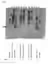 Fig. 08 - Method for detecting perilymphatic fistula