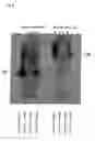 Fig. 09 - Method for detecting perilymphatic fistula