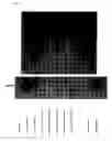 Fig. 10 - Method for detecting perilymphatic fistula