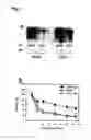 Fig. 04 - ALS-specific peptide composition