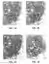 Fig. 02 - Antibody conjugates