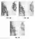 Fig. 06 - Antibody conjugates