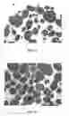 Fig. 03 - Inhibition of pancreatic islet aggregation