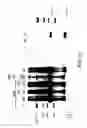 Fig. 11 - Methods for transfecting T cells