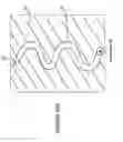 Fig. 45 - Anti-stiction technique for electromechanical systems and electromechanical device employing same