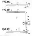 Fig. 03 - Compliant pin and electrical component that utilizes the compliant pin