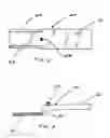 Fig. 03 - Marine motor blade system