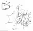 Fig. 02 - Hand exercising device