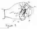 Fig. 04 - Hand exercising device