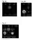 Fig. 08 - Compositions comprising lignosulfonates for crop protection and crop improvement