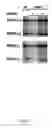 Fig. 03 - Yeast genes that affect viral replication