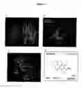 Fig. 02 - Small molecule inhibitors of STAT3 and the uses thereof