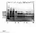 Fig. 08 - Ligation method